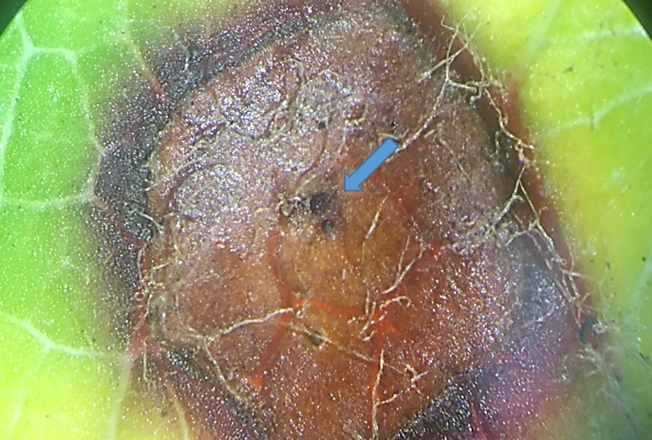 Close-up photo of an MLB lesion. Blue arrow is pointing to acervulus.